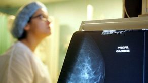 Mamografía en 3D más eficaz para diagnosticar cáncer de seno