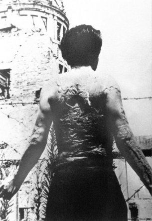 68 años desde la detonación de la bomba atómica
