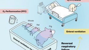 Esto se denomina ventilación enteral a través del ano o EVA (sus siglas en inglés).