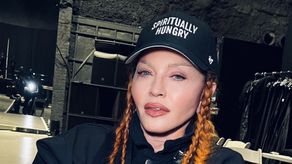 Madonna muestra su rostro luego de su última operación