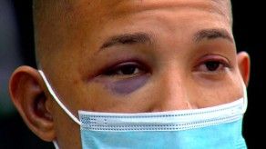 Deportista denuncia caso de supuesto abuso policial Deportista denuncia caso de supuesto abuso policial