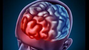 EEUU aprueba dispositivo contra la migraña