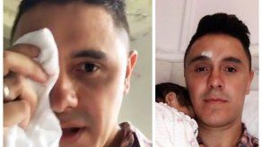 Joey Montana sufre accidente con la puerta de su carro