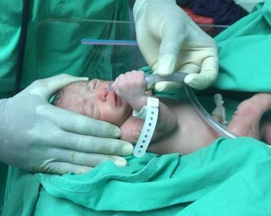 Mujer da a luz a cuatrillizos en el Hospital Santo Tomás