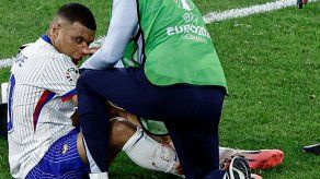 Eurocopa 2024: Mbappé desata ola de memes tras su fractura en la nariz