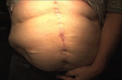 Denuncian negligencia médica en hospital privado de Chiriquí