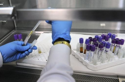 Epidemia del sida podría finalizar en 2030 (ONUSIDA)
