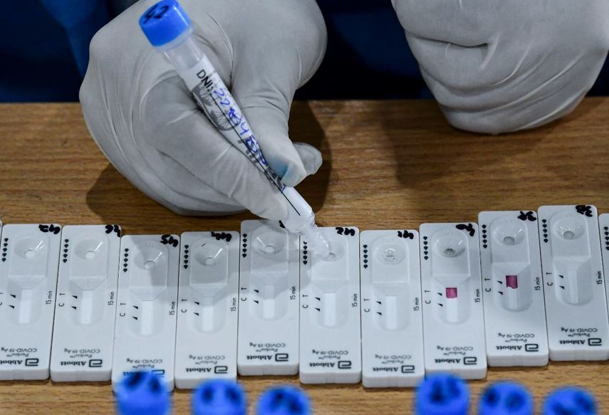 El director del Instituto Gorgas indicó que hay empresas que pueden estar introduciendo pruebas de manera ilegal.