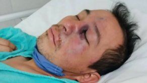 Hongo Negro en México: Gregorio tiene 34 años