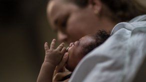 Casos de microcefalia vinculados al zika aumentan 16% en Brasil