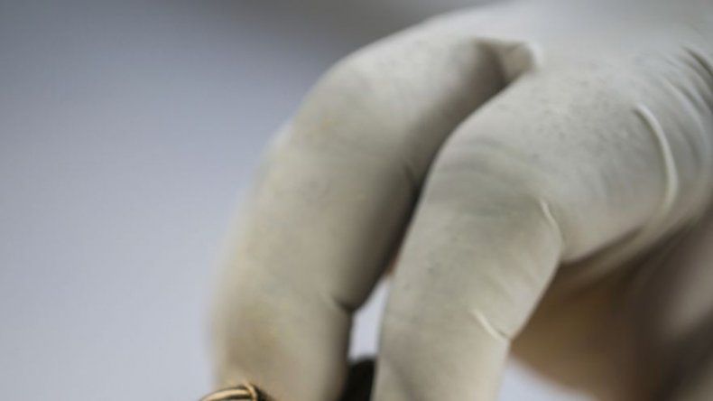 El veneno de una tarántula permite arrojar luz sobre la activación del dolor
