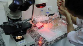 El ADN será clave para identificar a Cervantes