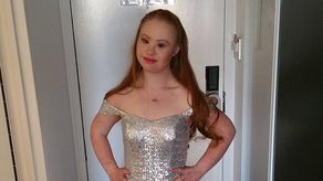 Modelo con Síndrome de Down: