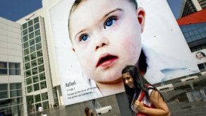 Introducción de un gen podría corregir la anomalía del síndrome de Down