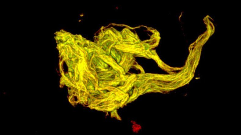 Neurobiólogo mexicano desarrolla técnica para reprogramar neuronas afectadas