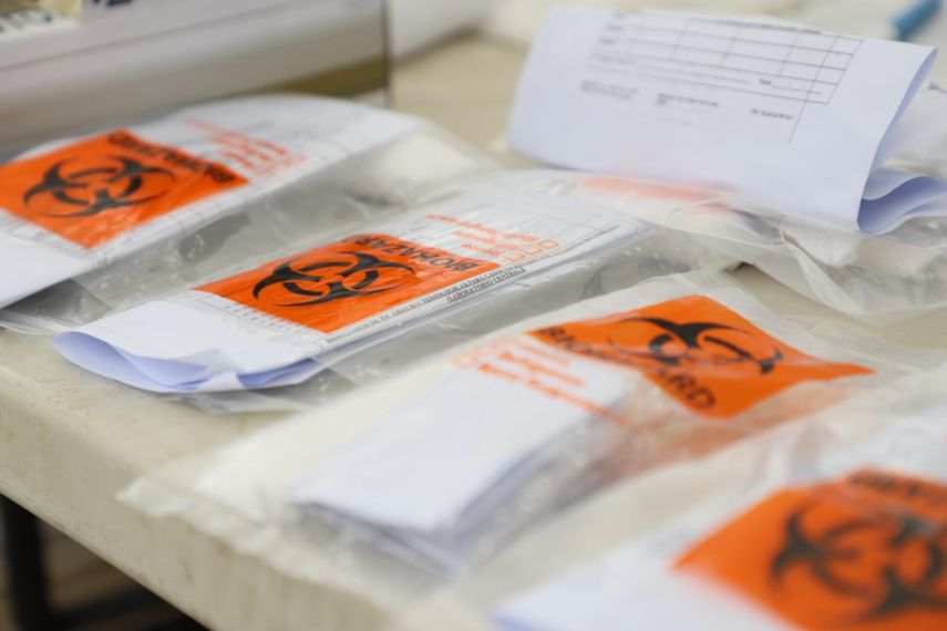 Pruebas para detectar la COVID-19.