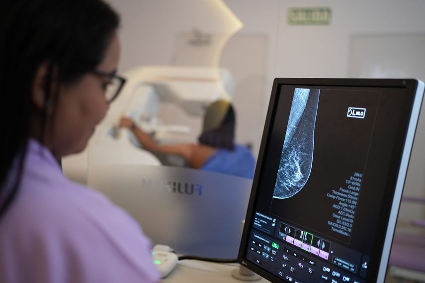 Nuevo mamógrafo de la CSS