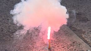 Ha disminuido la incidencia de niños con quemaduras por fuegos artificiales.