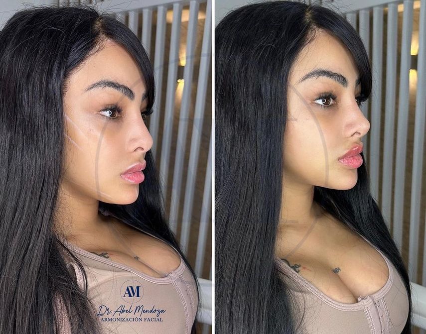 Fotografía del antes y después del retoque de la cantante Yailin La Más Viral. Fotografía del antes y después del retoque de la cantante Yailin La Más Viral.