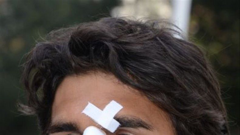 Brasil: Investigadores usan células madre para acelerar la cicatrización