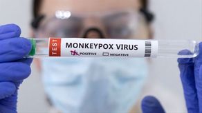 El Minsa recuerda que desde el pasado 24 de mayo, Panamá mantiene una alerta sanitaria en todo el país por la viruela del mono.