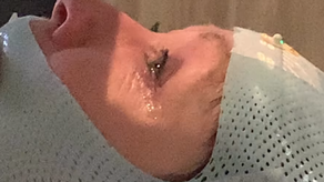 Shannen Doherty tiene metástasis en el cerebro