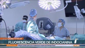 Cuida tu salud: Fluorescencia verde de indocianina