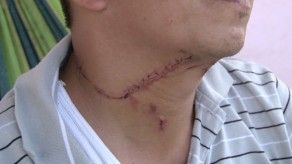 Taxista de Herrera sobrevive a brutal ataque para robarle B/.40.00