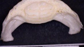Tomografía de mandíbulas de pez erizo revela 3 nuevas especies ya extintas