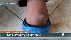 Preocupación por más de 30 casos de leishmaniasis en Calovébora