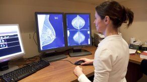 Identifican un gen esencial en la resistencia de un cáncer de mama agresivo