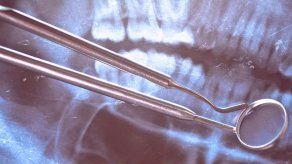 Mujeres con infección crónica de encías tienen más riesgo de padecer cáncer