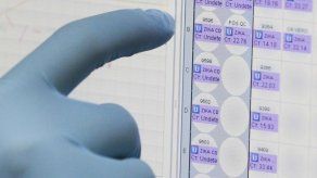 Prueba de orina simplificaría detección de zika