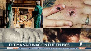 Última vacuna contra la viruela fue aplicada en 1965