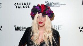 Kesha nació con un pequeño rabo