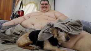 Colocan banda gástrica al hombre más obeso del mundo para mejorar su salud