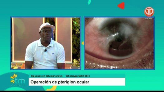¿En qué consiste una intervención quirúrgica de pterigion ocular?