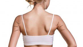 EEUU: Coágulo graso mata a mujer tras cirugía de glúteos