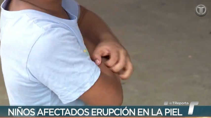 Padres de niños con erupciones y problemas respiratorios en escuela de Chilibre piden investigación