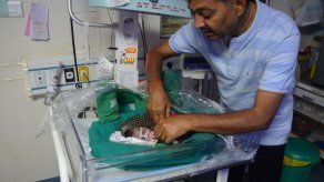 Bebé enterrada viva en India mejora según los médicos