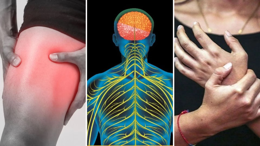 MINSA activa vigilancia por aumento de casos del síndrome de Guillain-Barré