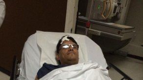 Literalmente me atropelló un camión