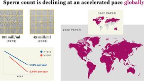 Un estudio apoya hipótesis de disminución mundial de concentración de espermatozoides
