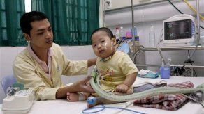 Una cepa virulenta de la aftosa hace estragos en Asia