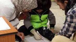 Prótesis en 3D devuelven la esperanza a mutilados de guerra