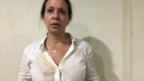 Opositora María Corina Machado dice que Maduro ordenó el ataque en su contra