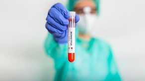 El primer caso de viruela del mono en Panamá se confirmó el 5 de julio.