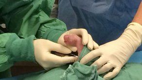 Murió el más pequeño de los pandas nacidos en un zoológico de EEUU