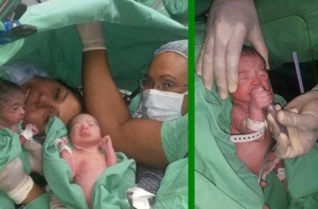 Mujer da a luz a cuatrillizos en el Hospital Santo Tomás