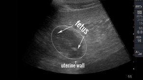 Ecografía prometedora de la hembra panda del zoo de Washington